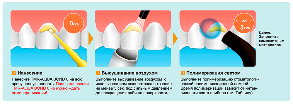 Ямакинаквабонд8